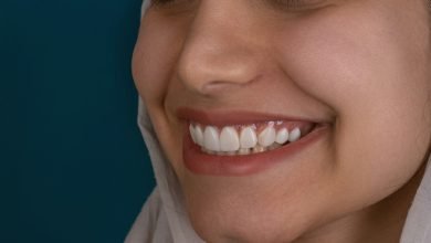 Confident Smiles Made Simple With All-on-4 Dental Implants
